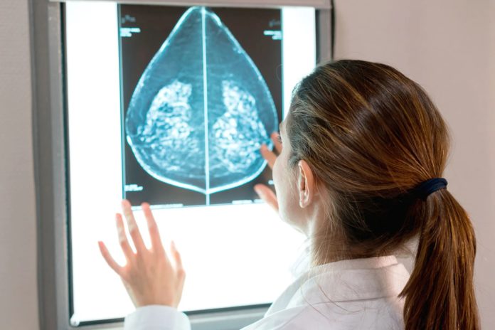 federal-task-force-suggest-mammograms-start-at-40,-not-50