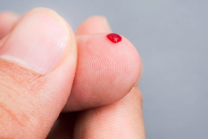 finger-prick-blood-test-promising-for-alzheimer’s-diagnosis