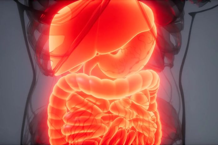 more-than-2-million-in-us.-have-inflammatory-bowel-disease