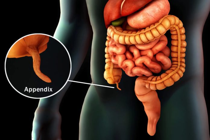 tiny-organ,-long-lasting-pain:-mystery-of-chronic-appendicitis