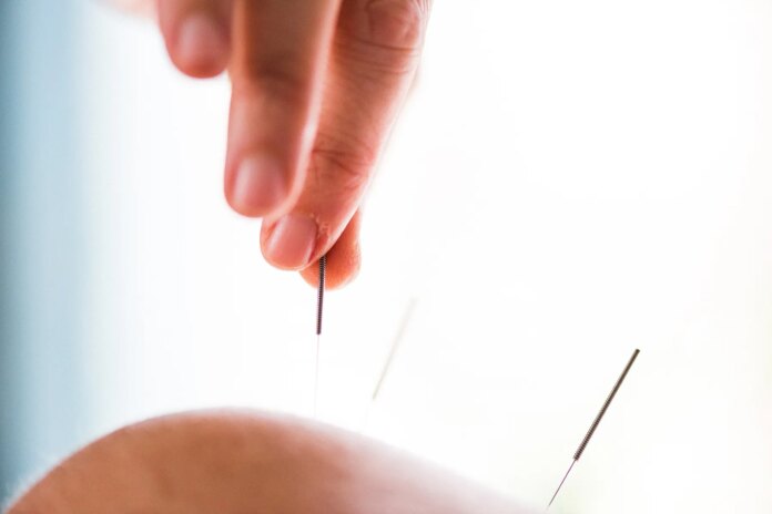 more-parents-turning-to-acupuncture-for-kids’-pain,-anxiety